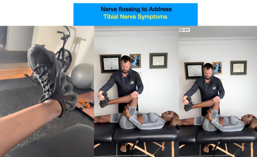 An stretch called tibial nerve flossing that addresses tibial nerve symptoms from damage. 